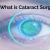 What is Cataract Surgery? - BARMAN EYE CARE CENTRE