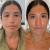 Facial Balancing In Island Park
