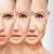 What Can a Dermatologist Do For My Wrinkles | Wrinkle Treatment 