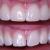 10 Great famous composite veneers Manchester costs Public Speakers - good cosmetic dentist in Manchester service