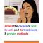 About the causes of bad breath and its treatment - 8 proven methods