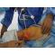Best Knee Replacement Surgeon in Hyderabad | Dr. Srinivas Kasha