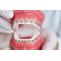 How Does An Orthodontist Help In Getting Straight Teeth?