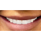 KAA Dentals Offer The Wide Range Of Treatments By 'experts