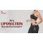 Are Liposuction Results Permanent?