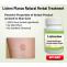 Natural Remedies for Lichen Planus Treat with Natural Essential Oil