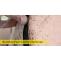 How to do Bed Bug Control in the Most Natural Ways