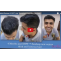 Best hair Transplant in India - Satya Hair Transplant Clinic