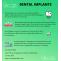 EZ Dental- Get your Implants fixed by the best Implant Dentist