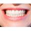 7 Benefits of Professional Teeth Whitening