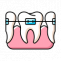 Diamond Invisalign Provider in faridabad