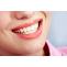 Cosmetic Dental Bonding: How To Get A Radiant Smile?