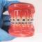 Do Adults Also Need Orthodontic Treatment?