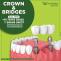 Crowns & Bridges