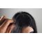 Dandruff vs Dry Scalp: How to Tell the Difference and Treat Accordingly