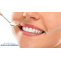 Top 4 Advantages Of Dental Bonding