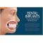 Dental Implants Sterling Heights MI, Rochester Hills MI, Troy MI - Michigan Periodontics