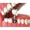 Dental Biomaterial Market 