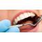 tooth extraction in bonham