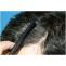 Manual FUE Hair Transplantation | Hair Transplant Clinic