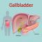 Gall Bladder Surgery at Krishna Medical Center (KMC) Hospital