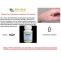 Granuloma Annulare Natural Treatment - Herbal Care Products