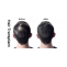 How do you get benefits from a hair transplant before and after?