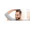 Advanced Treatment &amp; Facility For Hair Transplantation | Hair Transplant Dubai