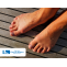 hammertoe treatment