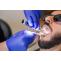How can an Emergency Dentist help you to get rid of tartar? - urbndentaltx