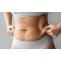 How Much Does Tummy Tuck Surgery Cost in India?