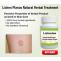 Home Remedies To Get Rid Of Lichen Planus - herbssolutionsbynature