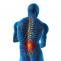 Low Back Pain: Causes And Preventions Methods: