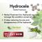 Hydrocele Treatment WithOut Surgery | Herbal Care Products - Herbal Care Products