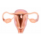 Cervical Polyps Treatment in Dubai | Endometrial Polyps