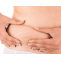 Stretch Marks Removal Treatment | Obesity &amp; Skin Care- Metamorphosis Clinic