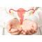 Understand Why Hysteroscopy is Done Before IVF
