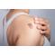 Keloid Treatment | Skin Scar Solution | Skinpase Clinic Kottayam
