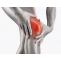 Knee Pain Treatments | Pain Specialist in Arizona