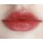 Best Lip Enhancement &amp; Augmentation Near Toronto | Tight Clinic