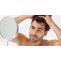 Does Dandruff cause hair loss - Hair Transplant Procedures And Treatments - Quora