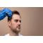 Mesotherapy | Severe Hair Loss Solution | Skinpase Kottayam