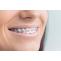  Metal Braces Treatment in India | Healing Touristry