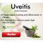 Natural Remedies for Uveitis and Lifestyle Changes Reduce the Symptoms - Herbal Care Products Blog