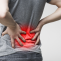 Sciatica And Back Pain - Peak To Shore Physiotherapy & Sports Medicine