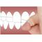 Dental treatments offered by Chetan Morjaria Dentist