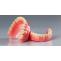 Full Denture Implants in Iowa | Emergency Dental Service