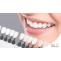 Teeth Whitening Calgary SE – Top-notch Dental Care for a Great Smile &#8211; smile32dentistry