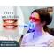 Professional Teeth Whitening 