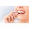 8 things to know before you have cosmetic dentistry - Blog